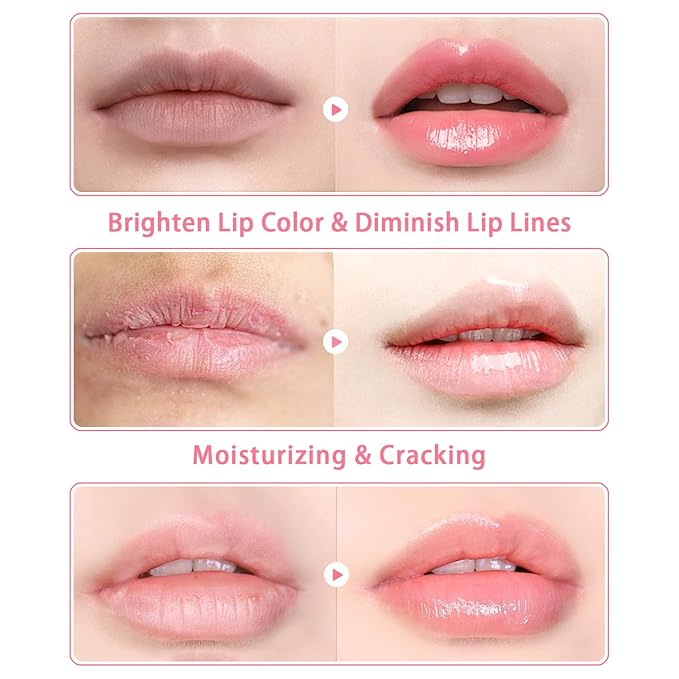 3 PCS Bee Lip Balm Lip Mask Honey Pot, Watermelon & Cherry & Coconut Lip Mask Propolis Moisturizing Lip, Hydrating Prevention Dry and Cracked Lip Scrubs Exfoliator (Watermelon & Cherry & Coconut)-FemmiqueWomen