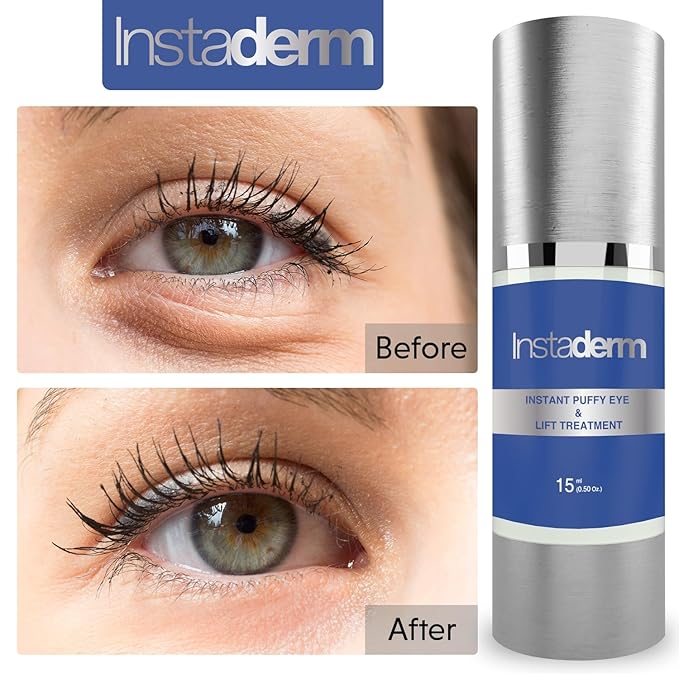 Instant Puffy Eye & Lift Treatment – Removes Under Eye Bags & Puffiness. Eliminate Dark Circles & Wrinkles. Naturally Ageless Hydrating Cream. Disappears Before Your Eyes Within Minutes.-FemmiqueWomen