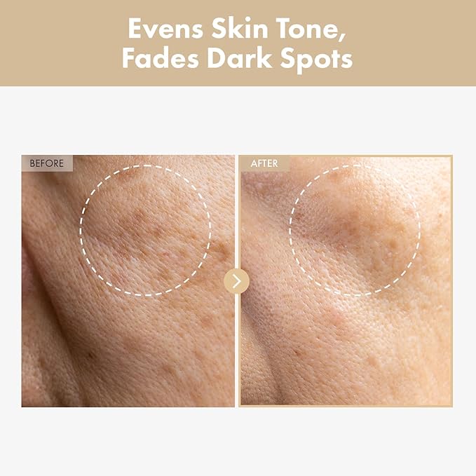 Rice Glow Milky Toner with 784,000ppm Korean Rice Water, Niacinamide, Ceramides, Panthenol, Glow, Glass Skin, Hydrating, Purifying, Fragrance-Free, Korean Skin Care, 250ml, 8.45 fl.oz.-FemmiqueWomen