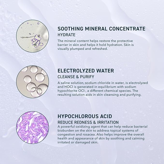 Skin Universal Skin Solution Hypochlorous Acid Spray for Face and Body. HOCL Facial Cleanser and Dermal Spray with Electrolyzed Water and Mineral Complex. pH-Stabilized Skin Care. 4oz-FemmiqueWomen