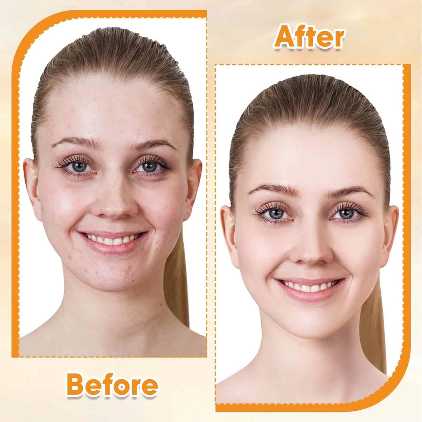 Vitamin E Rose Oil & Gua Sha Massage Tools Set, Gua Sha Oil for Face & Body, Organic Vitamin E Oil for Moisturizing and Hydrating, Anti Aging, Spa Gifts for Him Her-FemmiqueWomen