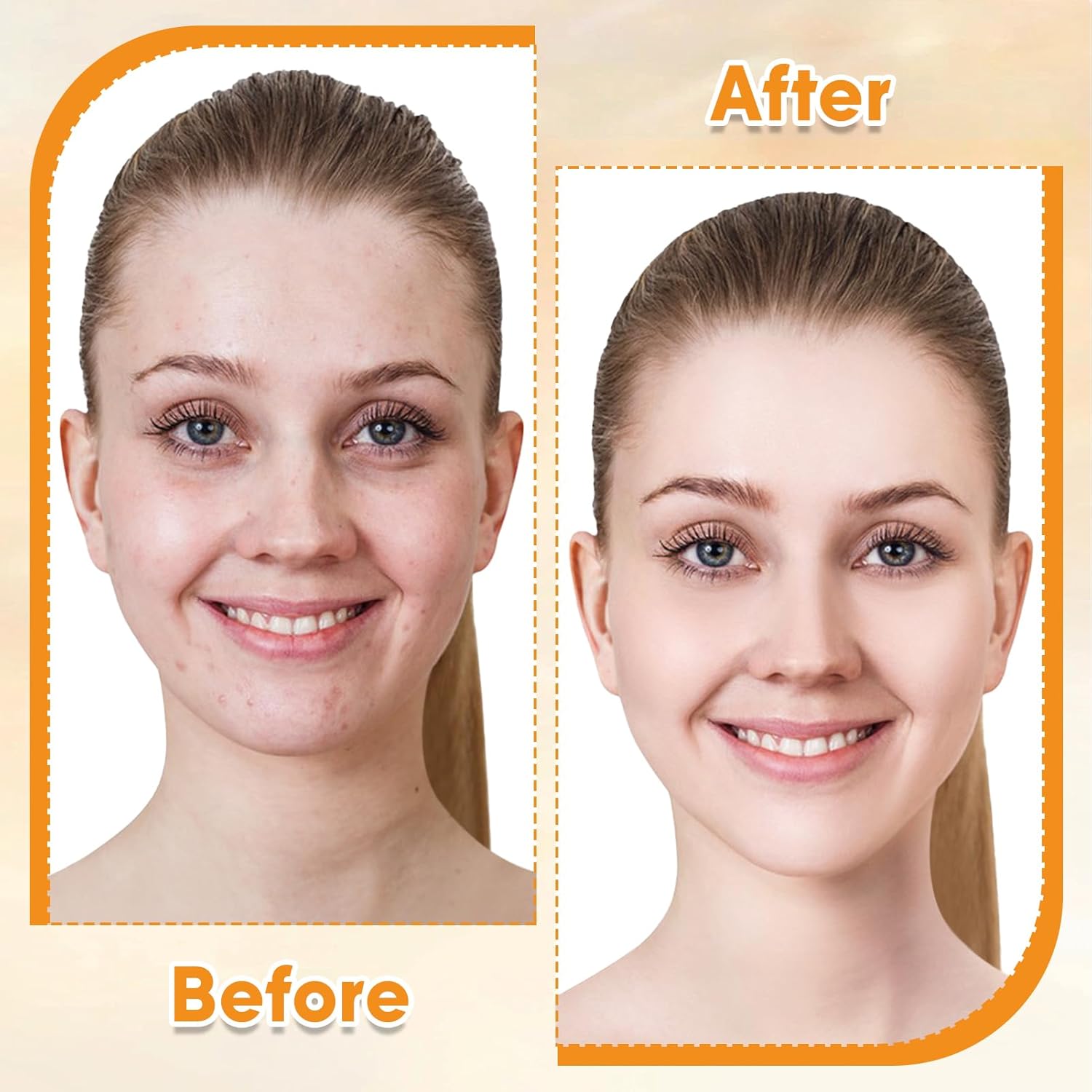 Vitamin E Rose Oil & Gua Sha Massage Tools Set, Gua Sha Oil for Face & Body, Organic Vitamin E Oil for Moisturizing and Hydrating, Anti Aging, Spa Gifts for Him Her-FemmiqueWomen