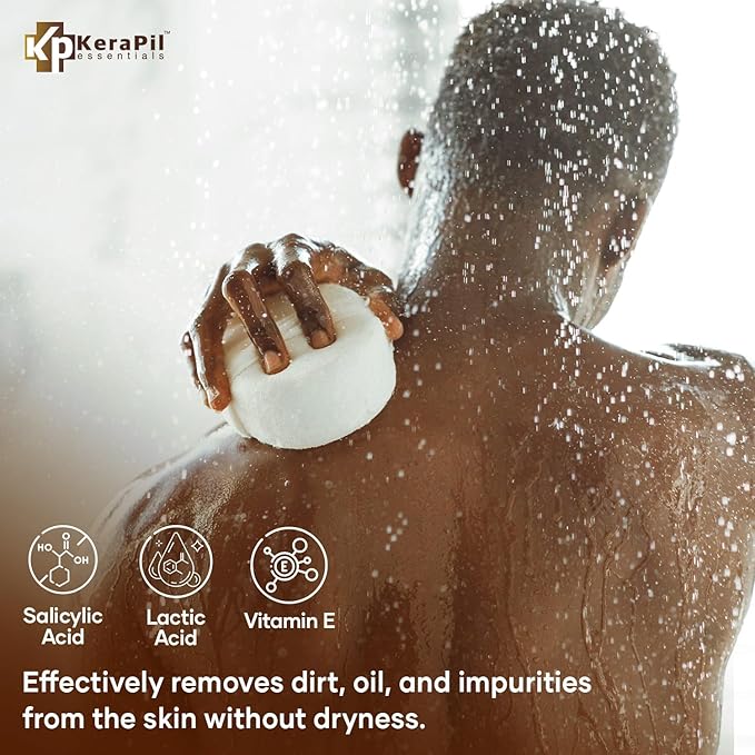 Exfoliating Body Wash with Salicylic Acid - No Dry Out, Gentle Exfoliates Rough and Bumpy Skin, Body Acne Wash, BHA & AHA - Coconut and Vanilla with Salicylic Acid - (16 fl oz)-FemmiqueWomen