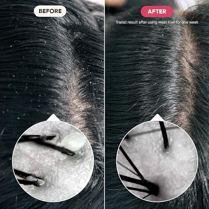 Ethique Heali Kiwi - Calming Solid Shampoo Bar for Dry, Itchy, Flaky, and Oily Scalps and Hair - Vegan, Eco-Friendly, Plastic-Free, Cruelty-Free, 3.88 oz (Pack of 1)-FemmiqueWomen