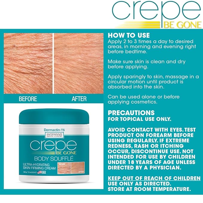 Crepe Be Gone Body Souffle Classic - Large 12 ounce - Ultra Hydrating Crepe Skin Firming Cream for Neck,Chest, Arms & Legs-FemmiqueWomen