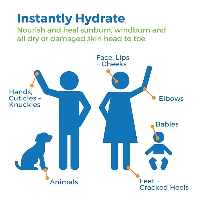 Waxhead Aftersun Body Butter for Sunburn Relief - Also great Tattoo Balm, Eczema Cream for Kids Adults, After Sun Lotion, Sunburn Treatment, Healing Salve-FemmiqueWomen