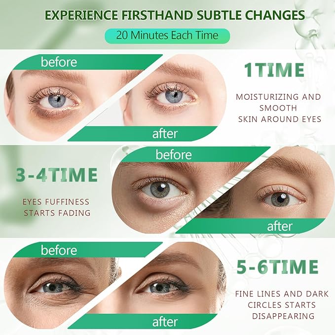 3 Packs 60 Pcs Under Eye Patches, Green+24K Gold+Pink, 30 Pairs Undereye Mask for Puffy Eye Dark Circle Treatment, Collagen Gel Pads Hydrating for Eye Bag Puffiness Wrinkle, Women Men Beauty Skin Care-FemmiqueWomen