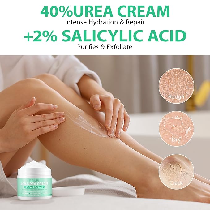 J&H Jasmine&Hyacinth 40% Urea Cream with 2% Salicylic Acid, Aloe, Feet/Heel Cream Moisturizer for Dry Cracked Heel, Knees, Elbows, Hands, Callus Remover, Intensive Hydrating Treatment-5.3 OZ/150 G-FemmiqueWomen