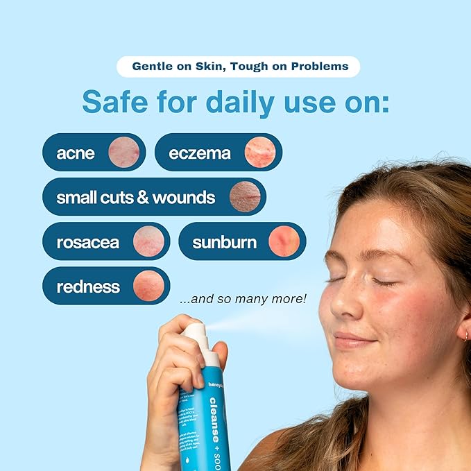 Hypochlorous Acid Spray – HOCl Face & Body Mist for Acne, Eczema & Irritation – Multi-Purpose Skin Repair – Eyelid Cleanser, Post-Workout/Procedure, Scalp & Sensitive Skin (2 oz+6.8 oz)-FemmiqueWomen