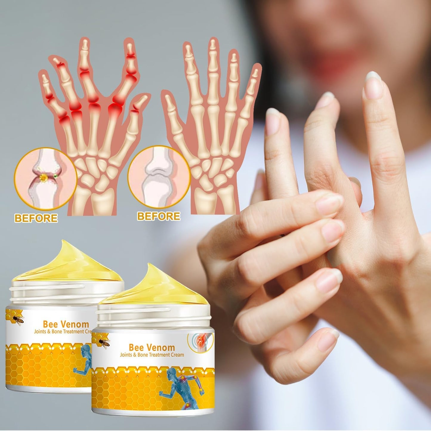 3 PCS Bee Venom Joint and Bone Therapy Cream, New Bee Venom Gel, Specializes in Muscle Soothing, for All Parts of The Body, for Men & Women-FemmiqueWomen