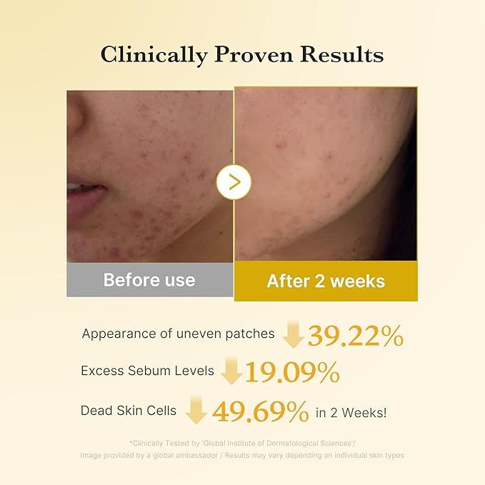 medicube Kojic Acid Turmeric Clarifying Toner Pad for Troubled Skin & Use After Spot Care | Soothing & Calming with Kojic Acid, Turmeric, Niacinamide, and Glycolic Acid | Korean Skin Care, 70 Pads-FemmiqueWomen