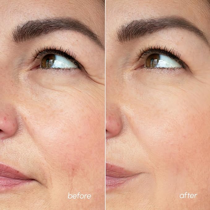 MAREE Face Moisturizer Retinol Cream for Face - Wrinkle Cream for Women - Anti Aging Face Cream - Facial Moisturizer with Collagen - Crema Hidratante Para la Cara for Skin Tightening-FemmiqueWomen