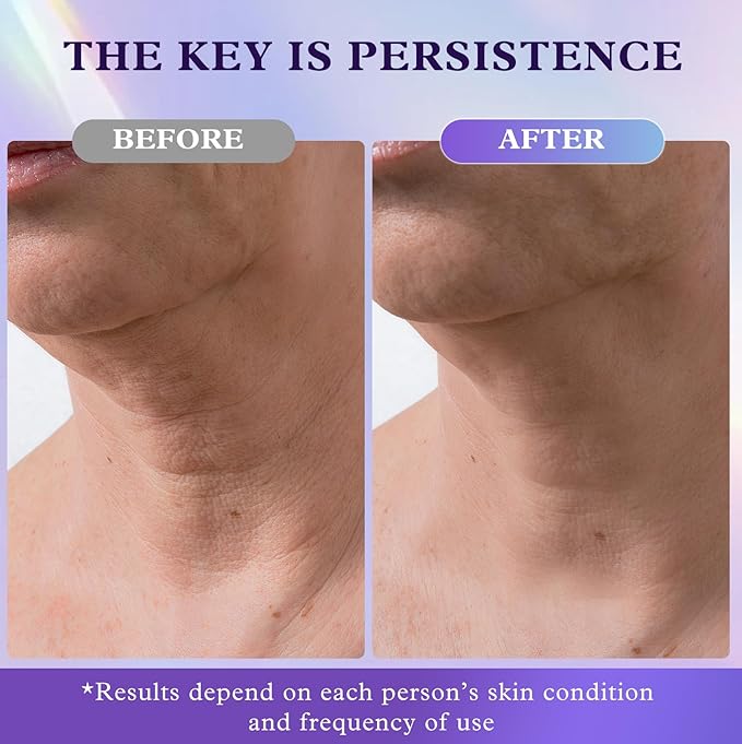 Retinol Neck & Face Wrinkle Cream for Women, Neck Cream for Tightening and Firming, Anti Aging Skin Care with Collagen & Hyaluronic Acid, Instant Face Lift Cream 1.7 Fl Oz-FemmiqueWomen