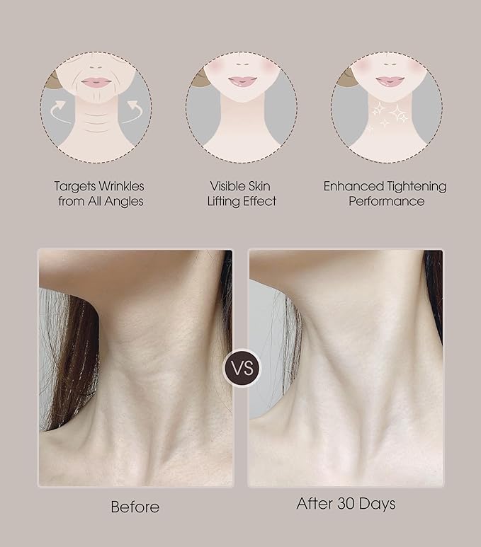 Intelligent Neck Lifting Device, 3 Color LED Neck Massager with Remote Control for Facial Massager | at Home Skin Care Tool-FemmiqueWomen