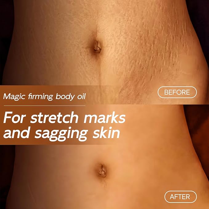 Magic Body Firming Oil, 3.38 FL OZ, Korean Skin Care Post-Shower Body Oil for Women – With 767,000ppm Jojoba Oil,to Tighten, Hydrate & Nourish Dry Skin, Lightweight & Non-Greasy for Full Body Use-FemmiqueWomen