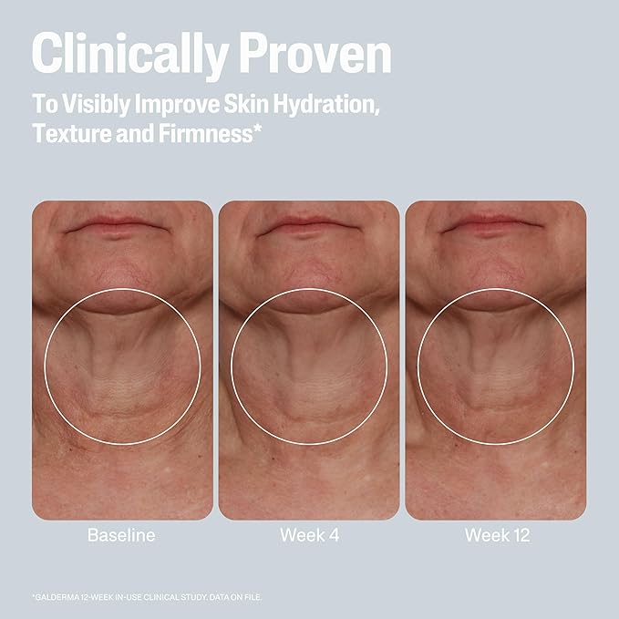 Cetaphil Skin Activator Hydrating & Firming Body Cream 12oz, Mandelic Acid (AHA) and Centella Asiatica (CICA) Cream, Hydrates and Firms Aging Skin, Anti-Aging Skin Care, 12 oz-FemmiqueWomen