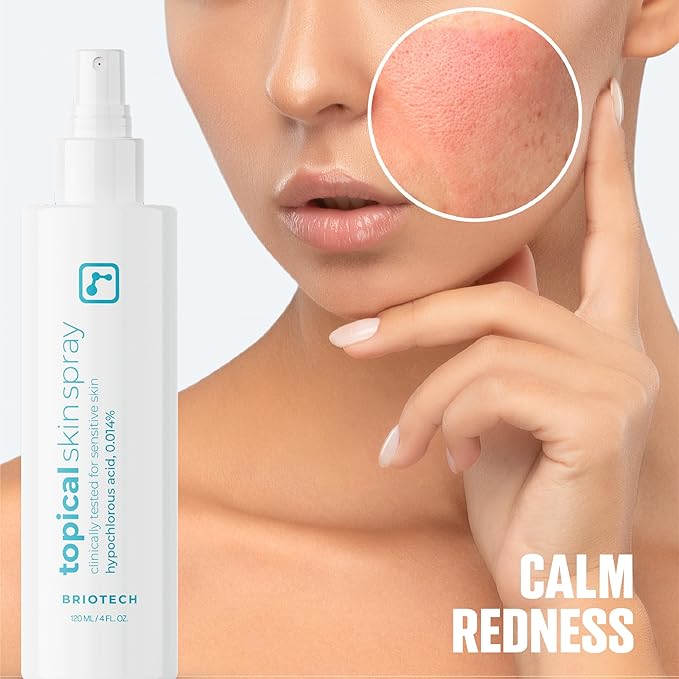 BRIOTECH Topical Skin Spray, Hypochlorous Acid Spray for Sensitive Skin, HOCl Facial Mist, Full Body Support Against Irritation, Calm Redness, Soothe Foot & Scalp, 2 oz Travel Size-FemmiqueWomen