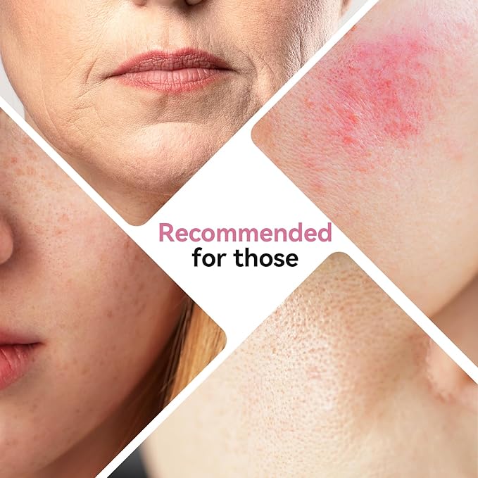 ISTON Bio-Collagen Face Mask,Overnight Revitalizing Hydrating Face Mask for Glowing Skin | Visible Firming, Deep Hydration & Refined Pores | Peptides, NMN & Hyaluronic Acid Masks For All Skin Type-FemmiqueWomen