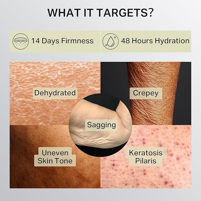 Ultra-Size Firming Retinol Body Lotion for Crepey Skin & Keratosis Pilaris with 0.05% Retinol, AHA, Collagen, Body Cream, Anti Aging Moisturizer 10.14 fl oz-FemmiqueWomen