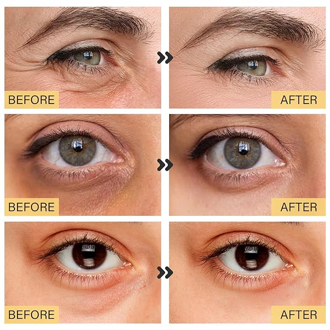 25 Paris Under Eye Patches Eye Mask for Puffy Eyes, Reducing Dark Circles, Anti-Aging & Refreshing, Collagen Eye Mask Eye Pads for Skin Care, 24K Gold-FemmiqueWomen