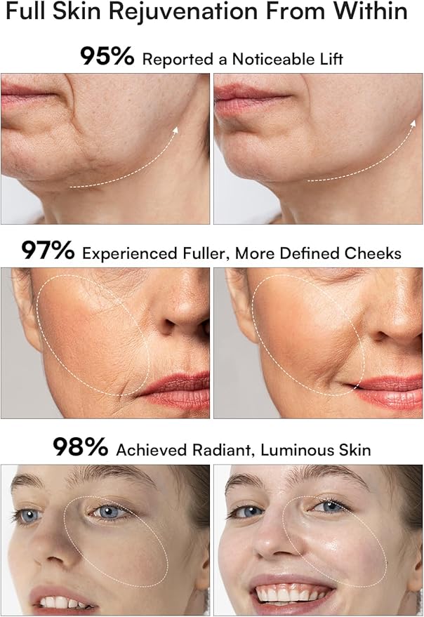 INIA 3-in-1 Red Light Therapy for Face and Neck Facial Massager True Beauty Glow Device, Lifting & Firming Skincare Tool-FemmiqueWomen