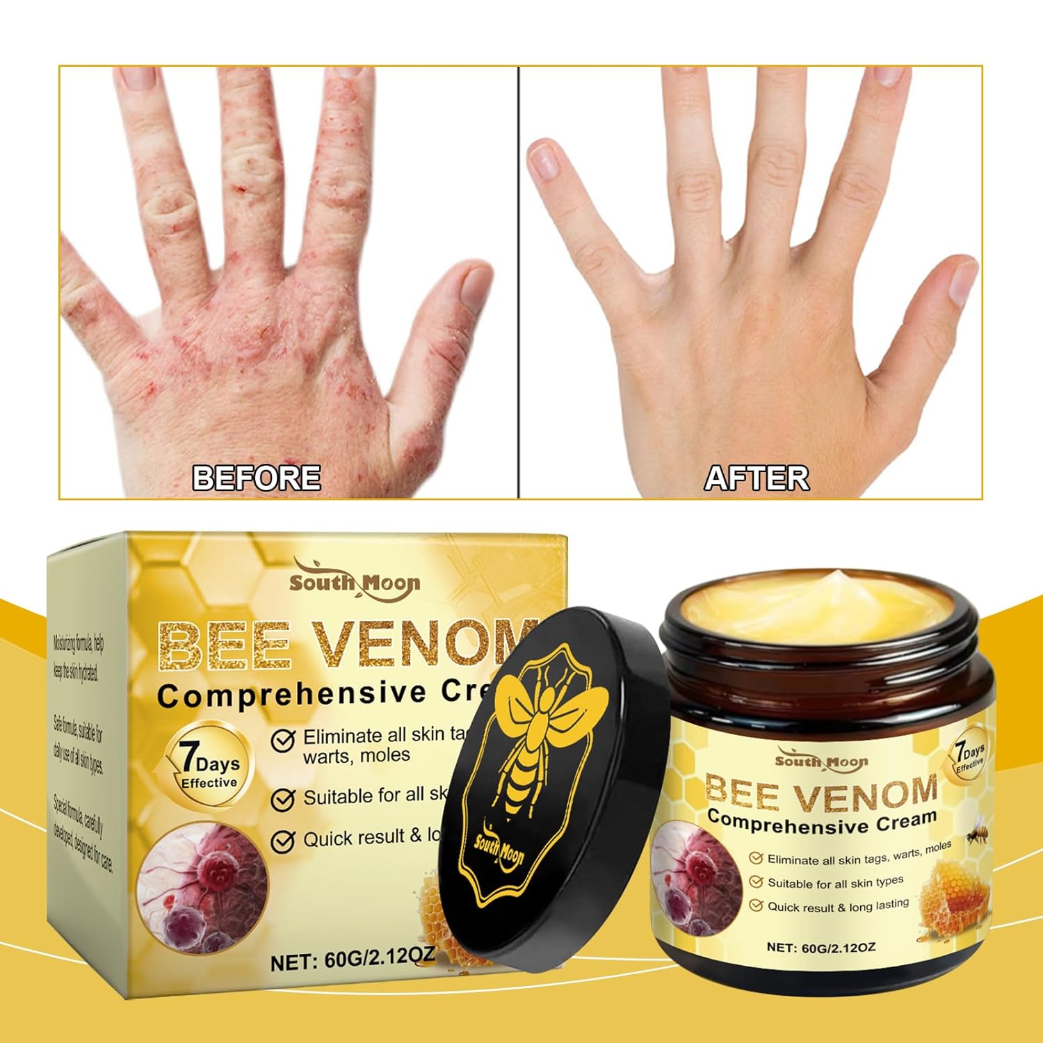 2PCS Bee Venom Skin Treatment Cream, 2025 Bee Venom Comprehensive Cream for All Skin Types, Skincare Treatment Creams, Visibly reduces blemishes-FemmiqueWomen