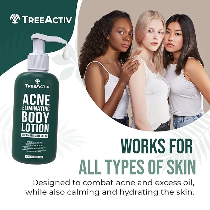 TreeActiv Acne Eliminating Body Lotion 8 fl oz | Clears Body, Back, Butt and Shoulder Acne | Anti-Acne Moisturizer | Prevents Future Breakouts | Cucumber Mint Scent-FemmiqueWomen