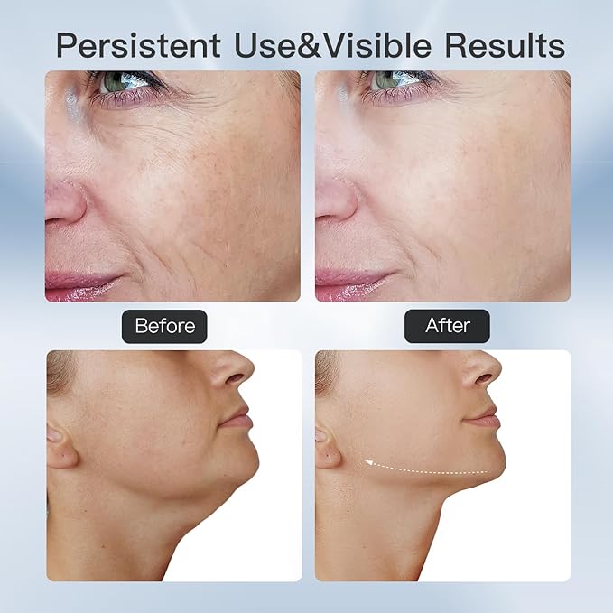 3-in-1 Beauty Massager for Face and Neck, Based on Triple Action LED, Thermal, and Vibration Technologies for Skin Care,Improve,Firm,Tightening and Smooth-FemmiqueWomen