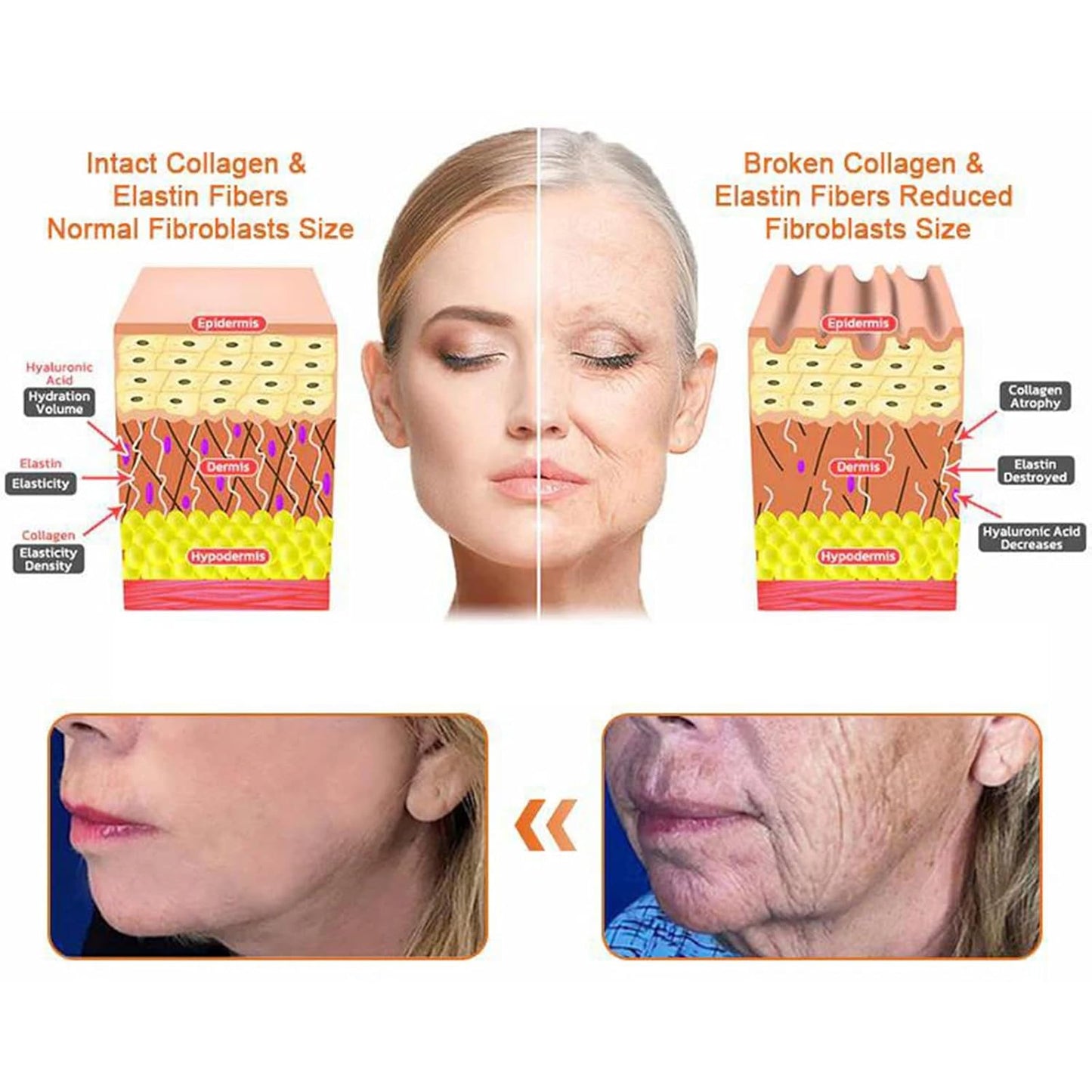 Bee Venom Comprehensive Cream, Professional bee venom cream for Removing and Repair, APKAPK Bee Venom Skin Treatment Cream, Natural Serum Suitable for All Skin Types (4 Pack)-FemmiqueWomen