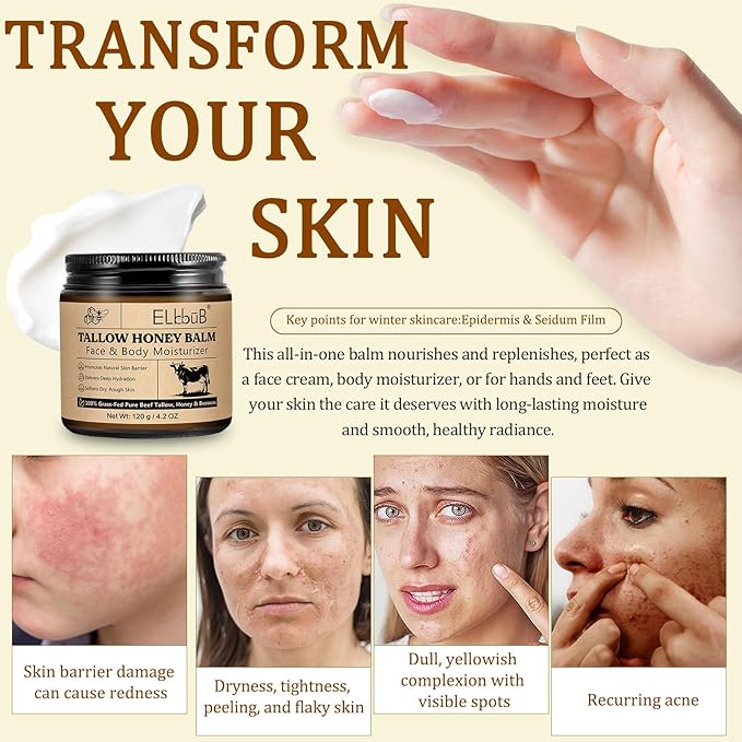 Whipped Tallow Cream for Face & Body - 100% Grass-Fed Beef Tallow, Natural Honey & Beeswax Moisturizer, Deep Hydration & Nourishment, Oil-Free & Unscented, Fast Absorbing-FemmiqueWomen