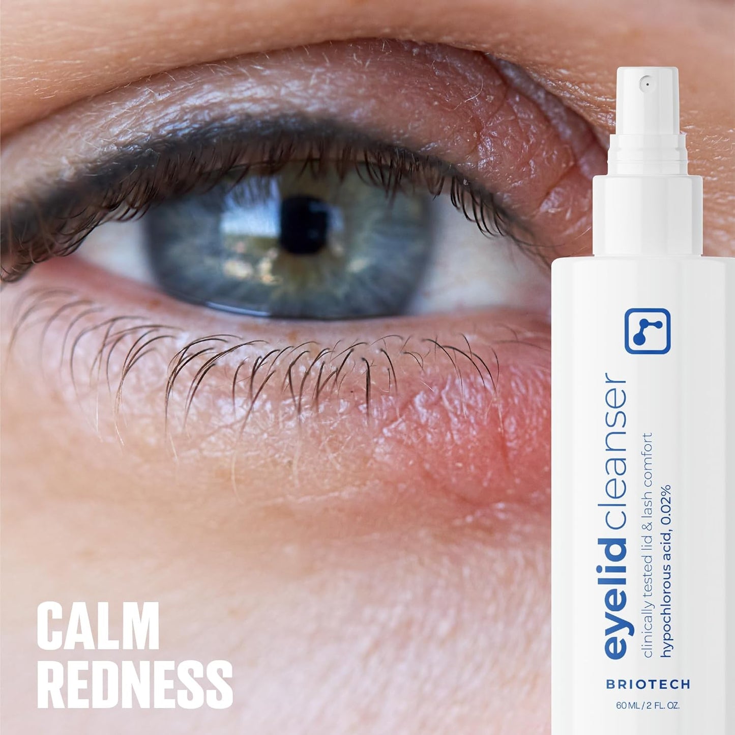 BRIOTECH Eyelid Cleanser, Hypochlorous Acid Spray, Lid & Eyelash Cleanser, Soothe Sensitivities, Calm Redness & Bumps, Support Against Irritation, Vegan, Travel Size 2 Fl oz (1 Pack)-FemmiqueWomen