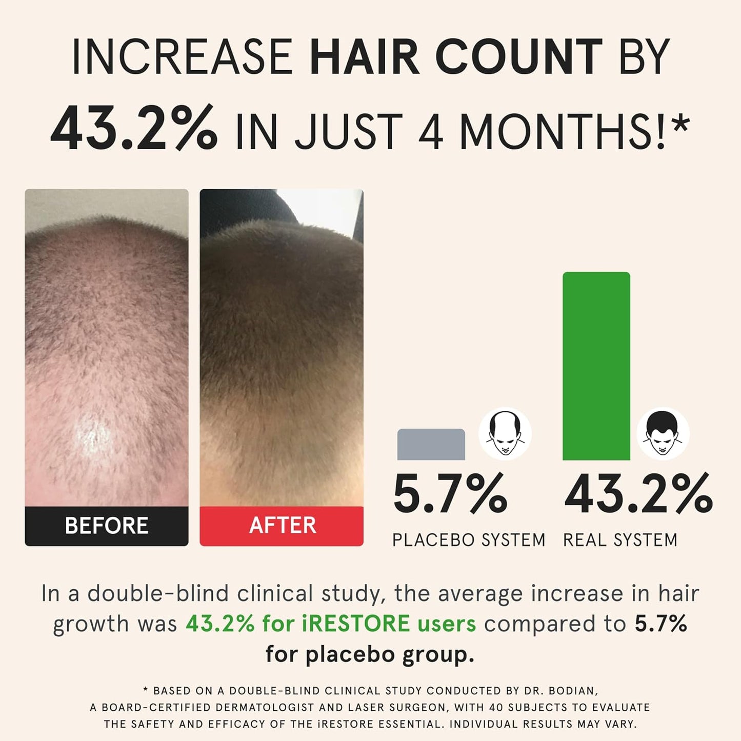 iRestore Essential Laser Hair Growth System + Rechargeable Battery Pack - FDA Cleared Hair Regrowth for Men & Women with Thinning Hair-FemmiqueWomen