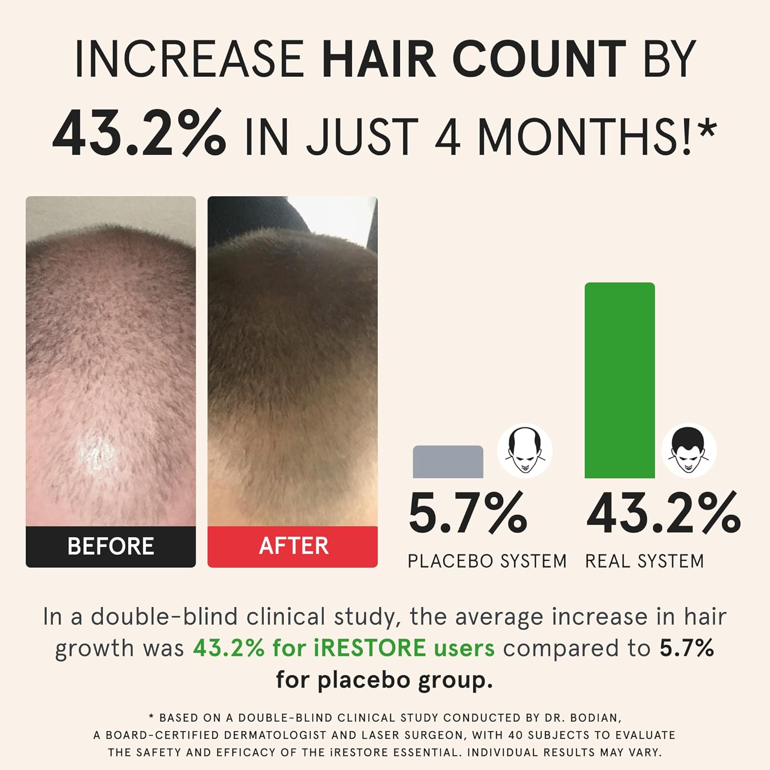 iRestore Essential Laser Hair Growth System + Rechargeable Battery Pack - FDA Cleared Hair Regrowth for Men & Women with Thinning Hair-FemmiqueWomen