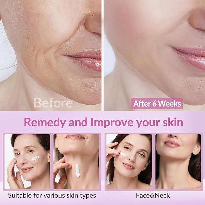 Neck Firming Creams for Tightening and Firming, Moisturizer Face Cream with Collagen, Hyaluronic Acid, Day & Night Anti-Aging Skin Tightening Cream Neck, Décolleté & Face – 1.7Fl Oz-FemmiqueWomen