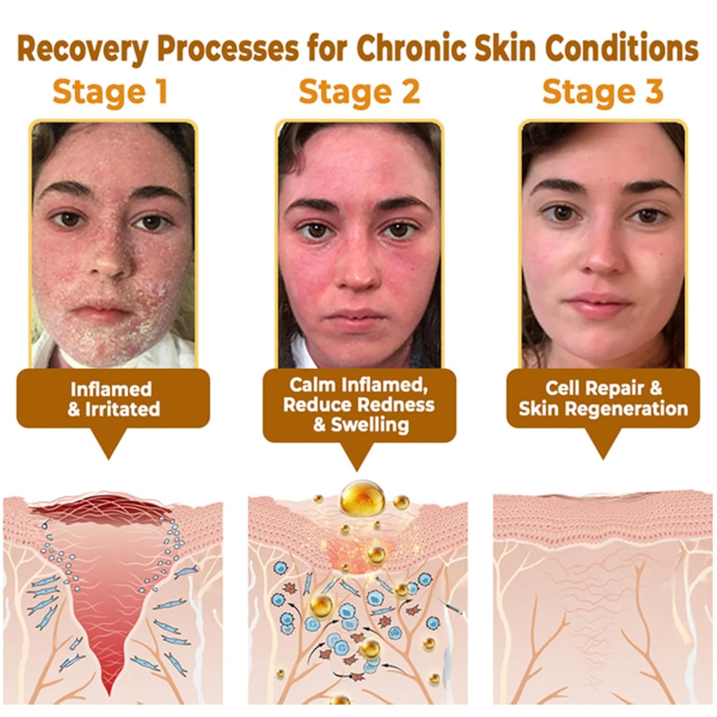 Bee Venom Skin Restoration Cream, Bee Venom Skin Treatment Cream, Repair skin and Firming, Effective In Reducing Blemishes (3)-FemmiqueWomen