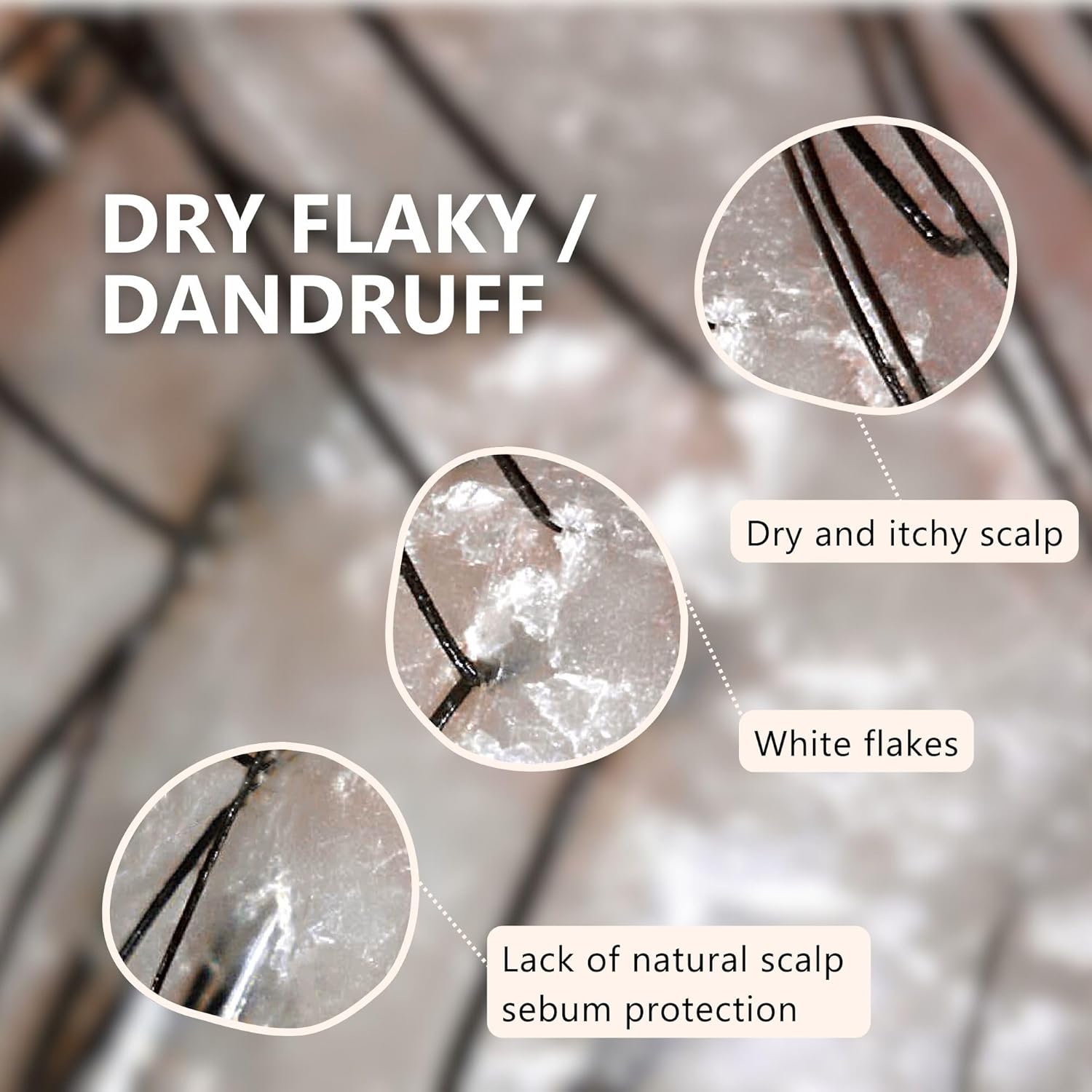 Aromase Dry Scalp Soothing Shampoo - Hydrates, Relieves Dryness and Itchiness - Amino Acid-Based Formula - No Parabens, SLS, or Silicone - 14 oz-FemmiqueWomen