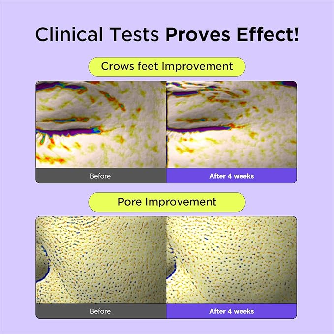 BY WISHTREND Vitamin A-mazing Bakuchiol Night Cream | Retinal, Peptide, Collagen, Ceramide NP, Centella Asiatica, moistfully plump overnight skincare (1.05 Ounce (Pack of 1))-FemmiqueWomen