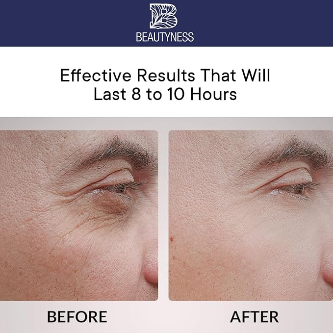 Instant Ageless Eye Cream – Anti Wrinkle Cream, Removes Under Eye Puffiness, Bags, Expression Lines, & Dark Circles. Powerfully Tighen & Lifts Sagging Skin. Disappears Before Your Eyes In Minutes.-FemmiqueWomen