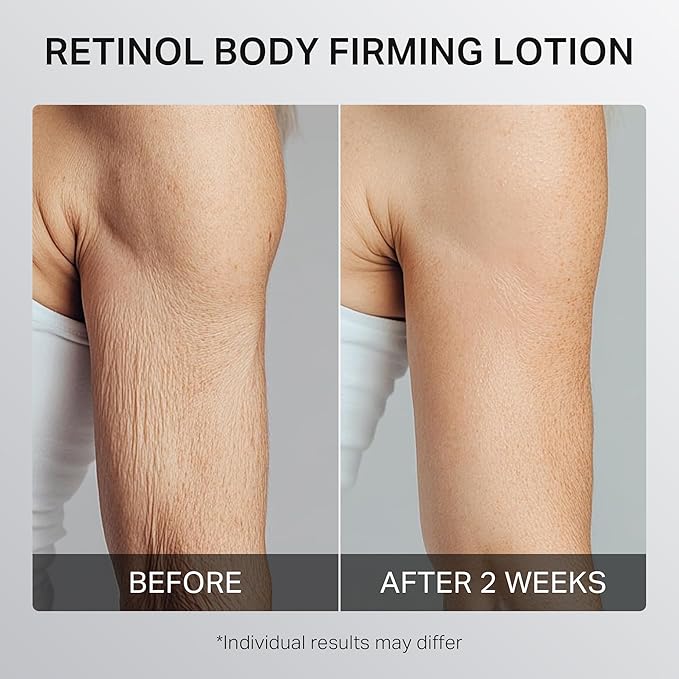 Ultra-Size Firming Retinol Body Lotion for Crepey Skin & Keratosis Pilaris with 0.05% Retinol, AHA, Collagen, Body Cream, Anti Aging Moisturizer 10.14 fl oz-FemmiqueWomen