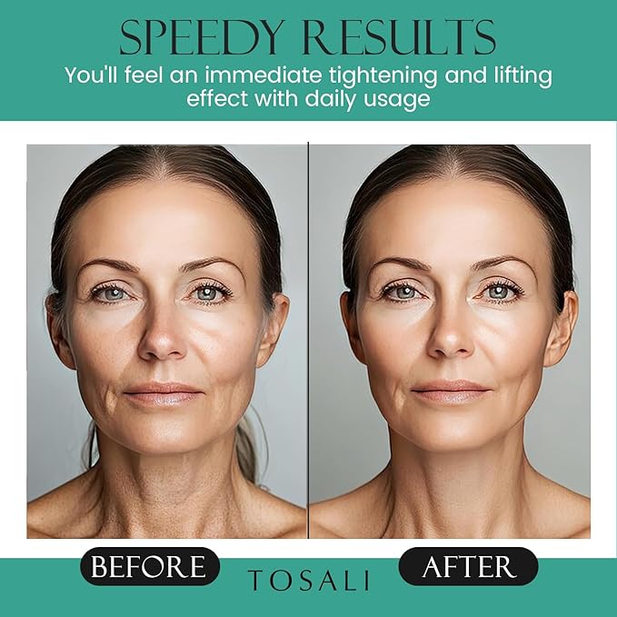 Anti Aging Face Cream for Women, 1.7 oz - Niacinamide Cream, Hydrating Face Moisturizer with Multivitamins - Day & Night Cream for Face with Anti Aging Effect, Skin Care for All Skin Types-FemmiqueWomen