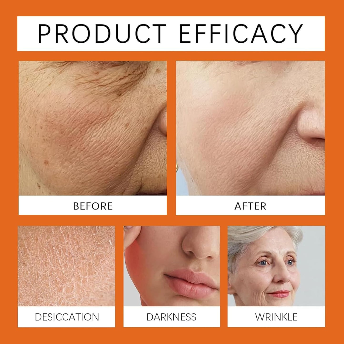 Bee Venom Comprehensive Cream, Professional bee venom cream for Removing and Repair, Bee Venom Skin Treatment Cream, Natural Serum Suitable for All Skin Types (1 Pack)-FemmiqueWomen