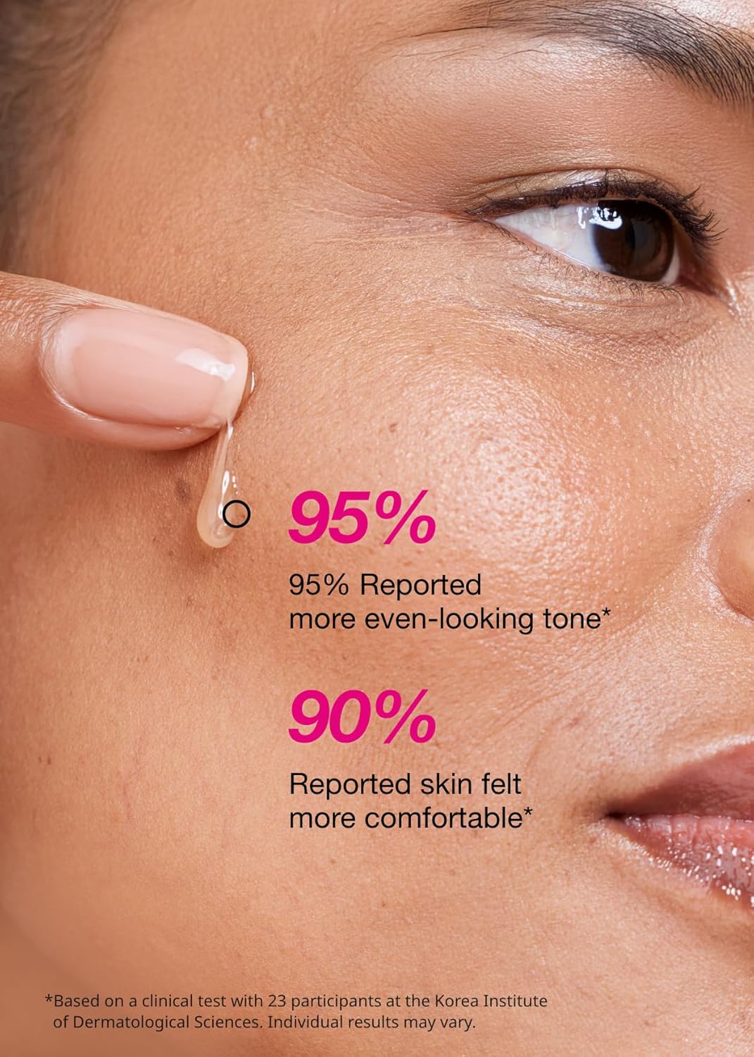 ISOI Blemish Care Up Serum for Face, Vegan Hydrating Serum for Smooth & Glass Skin Effect, Skin Barrier & Moisture Balance for Women, Arbutin, Korean Skin Care (1.18 fl. oz, 35ml)-FemmiqueWomen