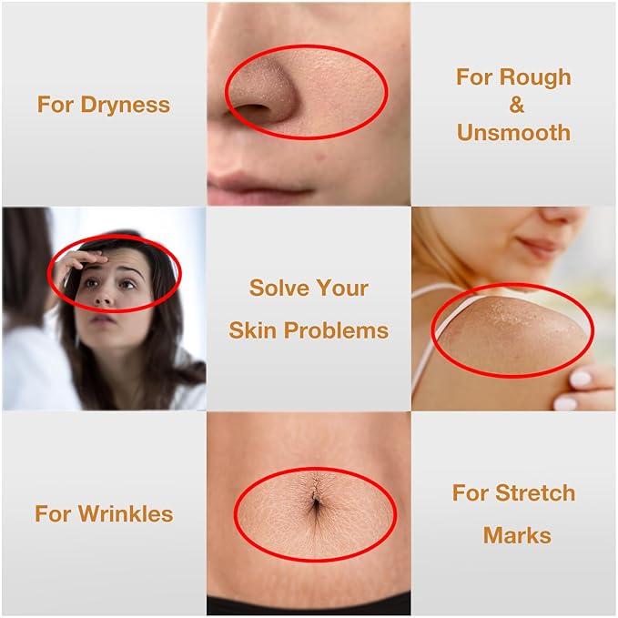 2PCS Folic Acid&Amino Acid,Essence combination of oil and lotion,Age-Defying Vegetable Glycerine for Skin Firms, Smooth, Anti Stretch Mark, Moisturizing 6.7 OZ +3.7 OZ-FemmiqueWomen