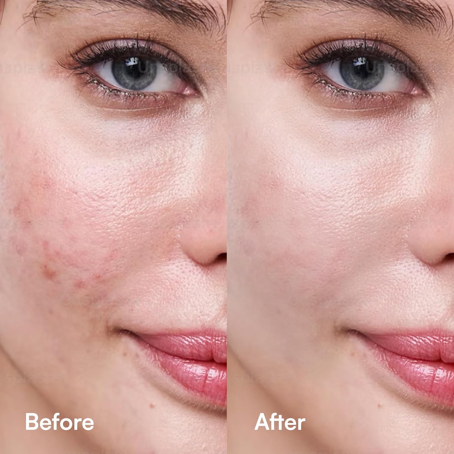 C Berry Oil Serum with Vitamin C, Sea Buckthorn, Rosehip, Jojoba, Squalane - Reduces Hyperpigmentation, Age Spots, Scars, Fine Lines - Nail and Cuticle Treatment - Glowing Skin, 1 fl. oz-FemmiqueWomen