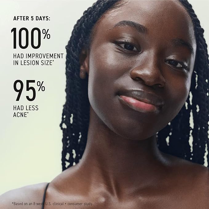 Rodan + Fields Spotless Regimen | Benzoyl Peroxide Face Wash for Sensitive Skin | Skincare Sets & Kits | Skin Care for Adults & Teens with Stubborn Acne | All Skin Types