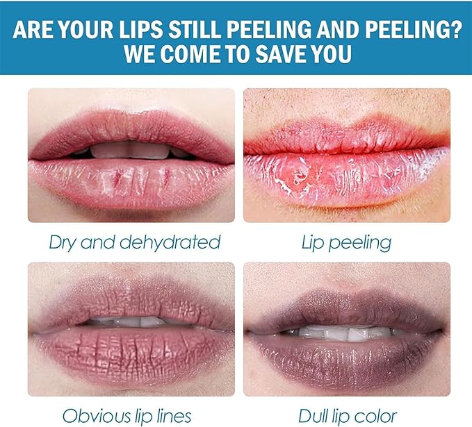 2pcs Lip Lightening for Dark Lips Lip Brightener for Smokers Dark Lip Treatment Lightening Cream for Pink Lips Lip Lightener for Smoker Lips Lip Lightening balm for Men and Women (Orange)-FemmiqueWomen