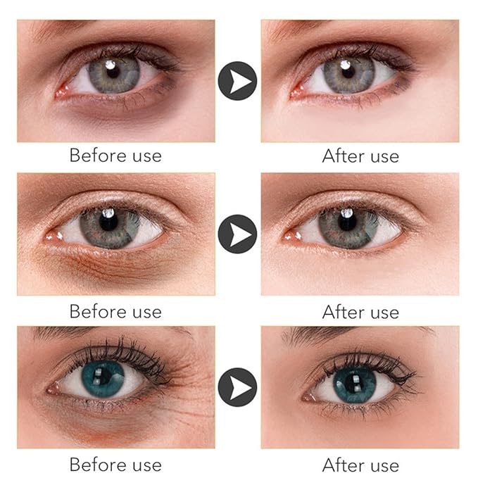 30 PCS Under Eye Collagen Patches,Crystal Pink Collagen Lip Masks，Gold Moisturizing Under Eye Mask，moisturizing skin, anti-chapping and anti-aging.…-FemmiqueWomen