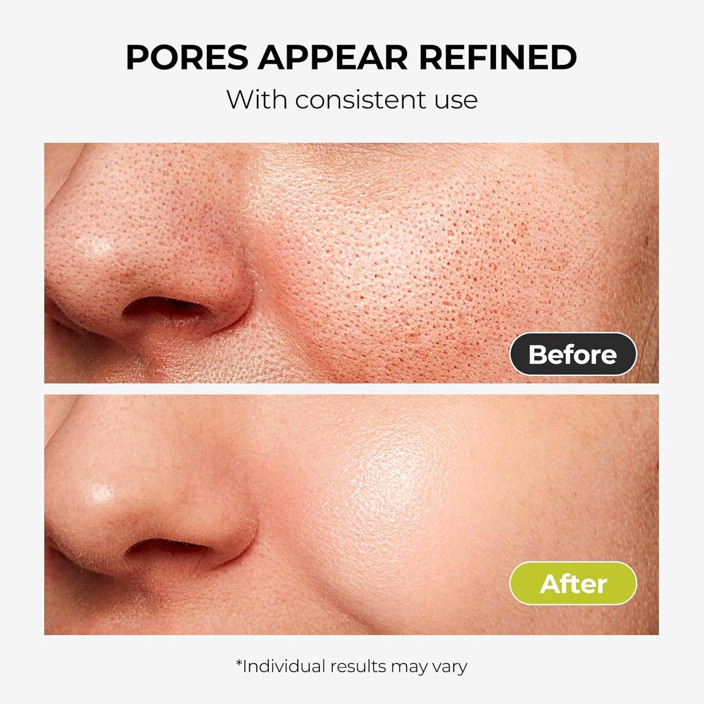 2% Salicylic Acid Face Serum for Oily, Blemish-Prone Skin - Treatment with Witch Hazel to Control Oil, Minimize Pores, Exfoliating & Soothing Skin - For Men & Women, 1.01 Fl Oz.-FemmiqueWomen