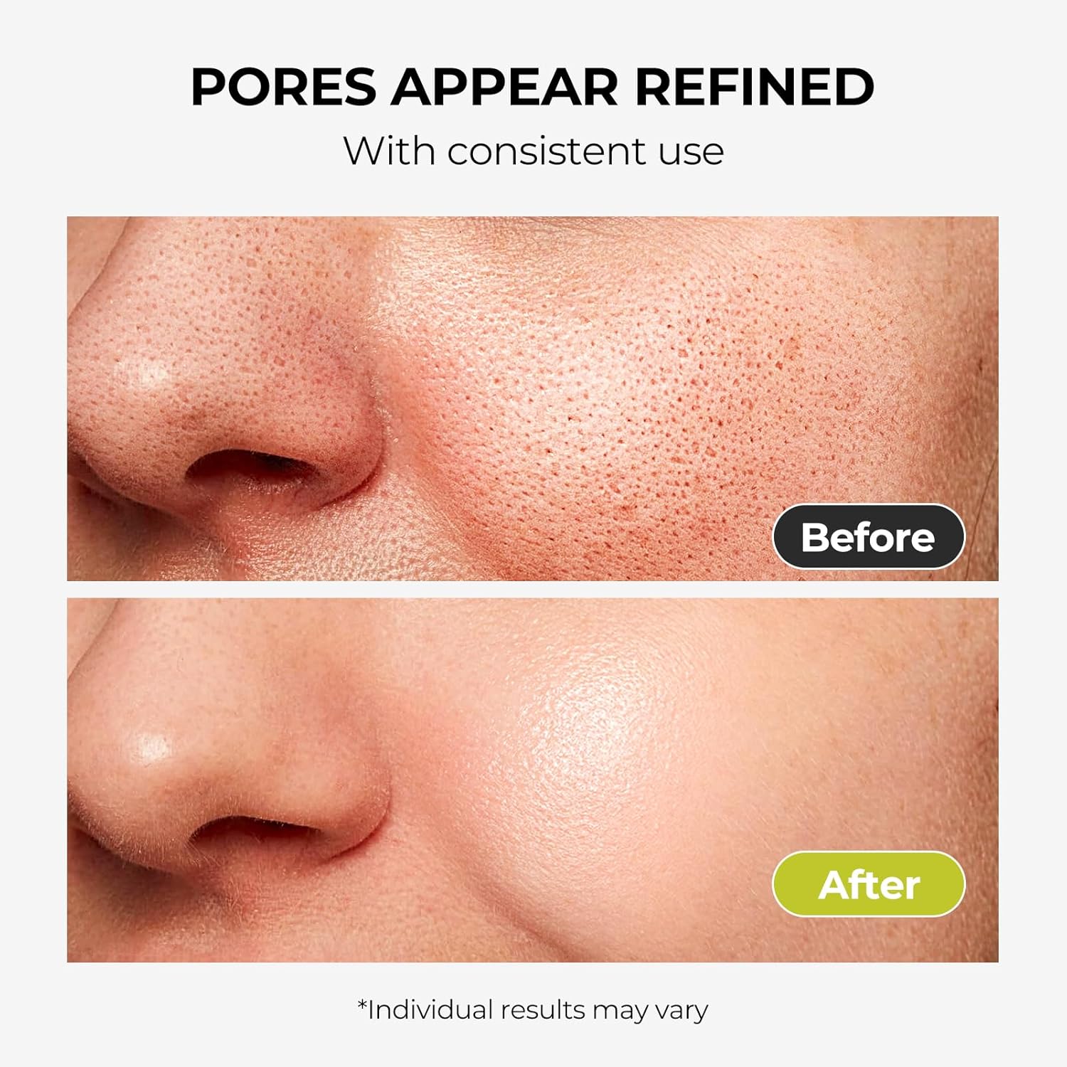 2% Salicylic Acid Face Serum for Oily, Blemish-Prone Skin - Treatment with Witch Hazel to Control Oil, Minimize Pores, Exfoliating & Soothing Skin - For Men & Women, 1.01 Fl Oz.-FemmiqueWomen