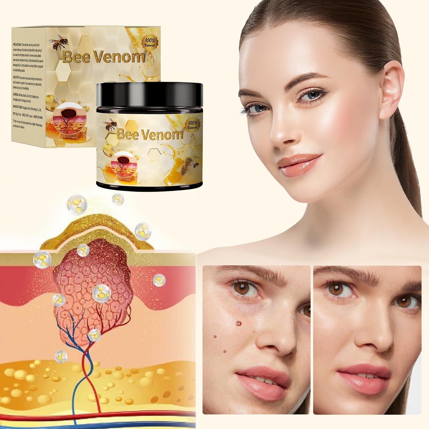 2pcs Bee Venom Treatment, New Professional Bee Venom Repair Cream, Bee Venom Cream for All Body Parts-FemmiqueWomen